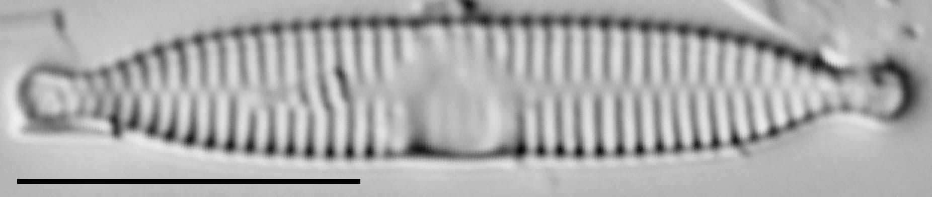 Fragilaria recapitellata LM7