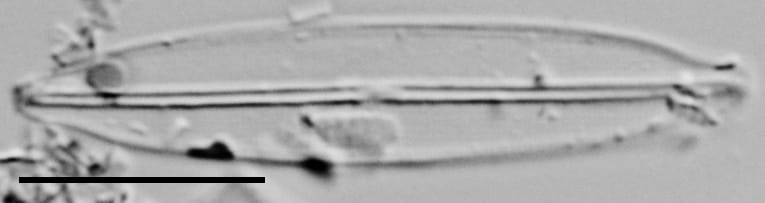 Frustulia pseudomagaliesmontana LM1