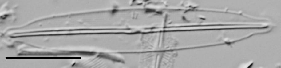 Frustulia pseudomagaliesmontana LM2