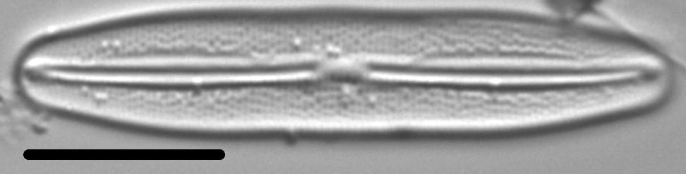 Frustulia amosseana LM5