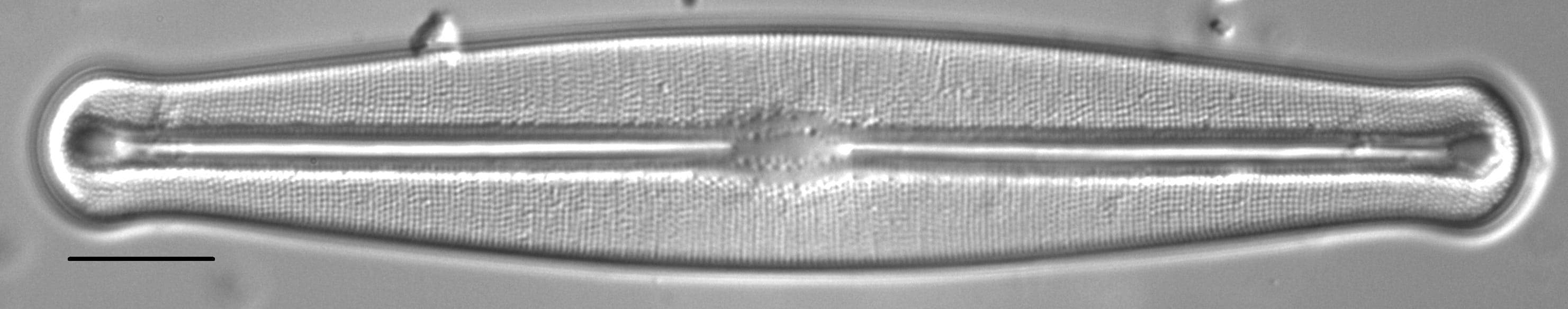 Frustulia esandalliae LM1