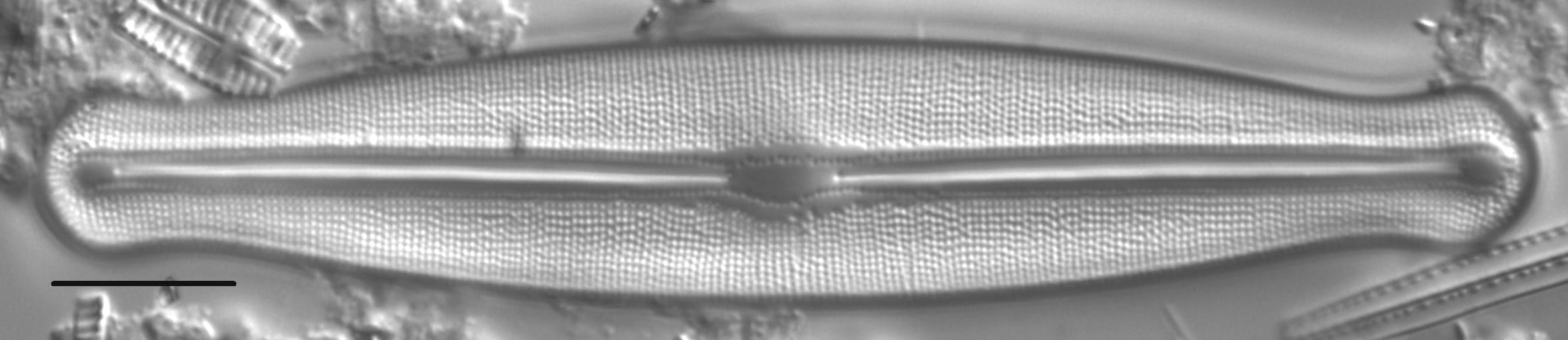 Frustulia esandalliae LM4