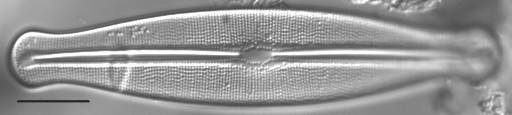 Frustulia esandalliae LM6