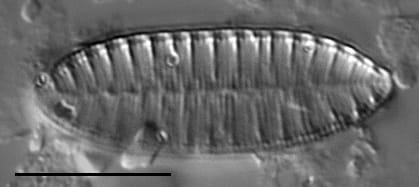 Surirella angusta LM2