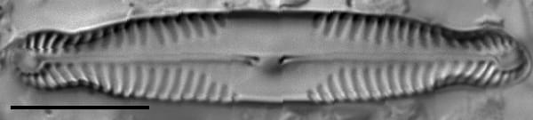 Pinnularia saprophila LM2