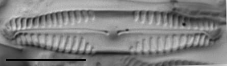 Pinnularia saprophila LM5
