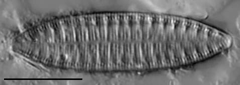 Surirella angusta LM3