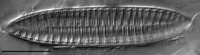 Surirella angusta LM5