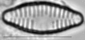 Fragilaria vaucheriae LM1