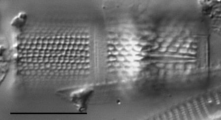 Aulacoseira muzzanensis LM2