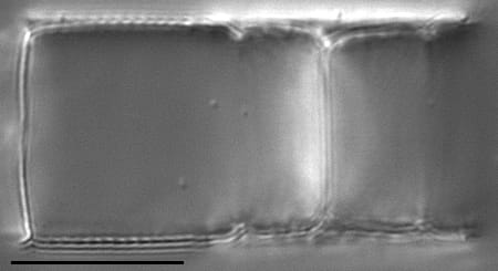 Aulacoseira muzzanensis LM3