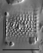 Aulacoseira muzzanensis LM1