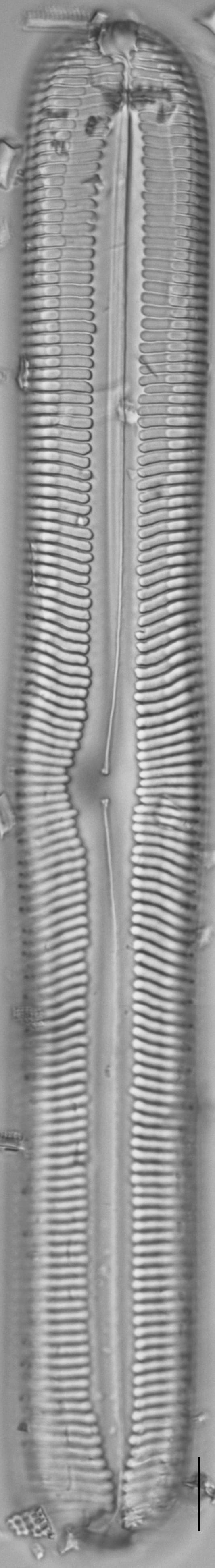 Pinnularia spinifera LM5