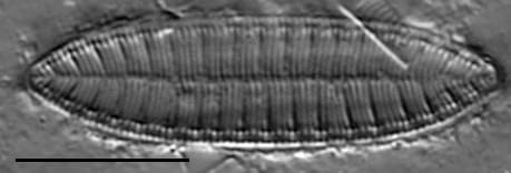 Surirella angusta LM6