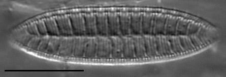 Surirella angusta LM7