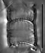 Aulacoseira humilis LM2