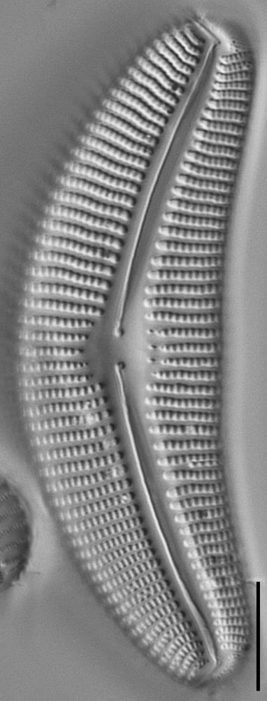 Cymbella proxima fo. gravida LM2