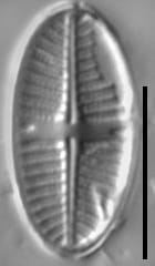 Platessa stewartii LM7