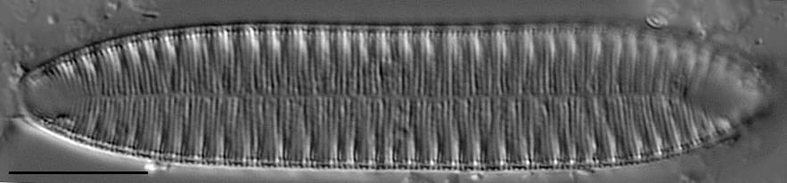 Surirella angusta LM1