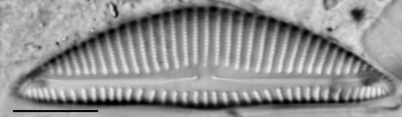 Encyonema minimum var pseudogracilis LM7