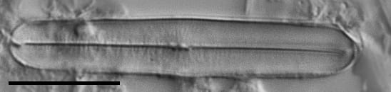 Fallacia latelongitudinalis LM3