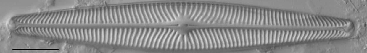 Navicula radiosa LM1