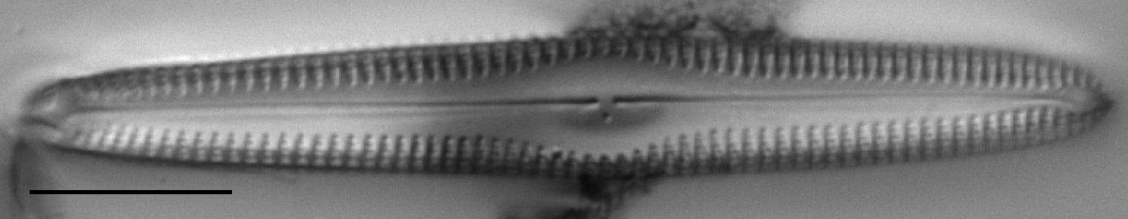 Gc53921  Gomphonema Freesei 1