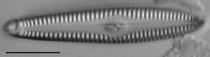 Gc53921  Gomphonema Freesei 4 Holotype