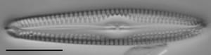 Gc53921  Gomphonema Freesei 5