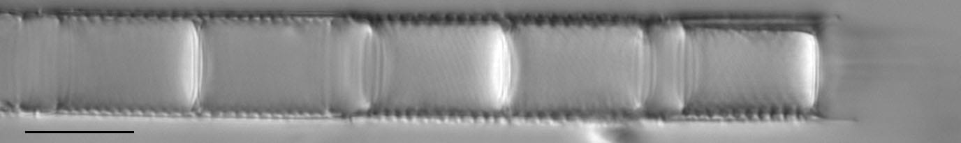 Aulacoseira granulata LM1