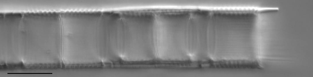 Aulacoseira granulata LM3