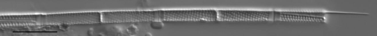 Aulacoseira granulata var. angustissima LM1