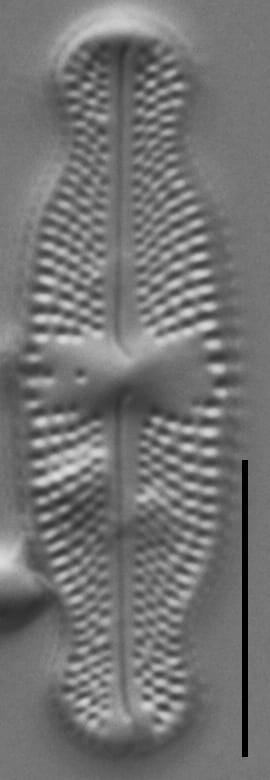 Luticola ventricosa LM1