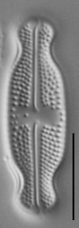 Luticola ventricosa LM5