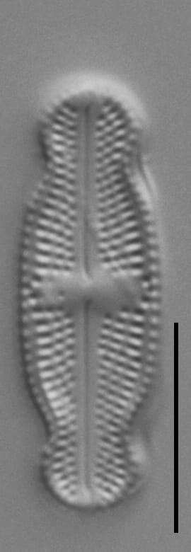 Luticola ventricosa LM6