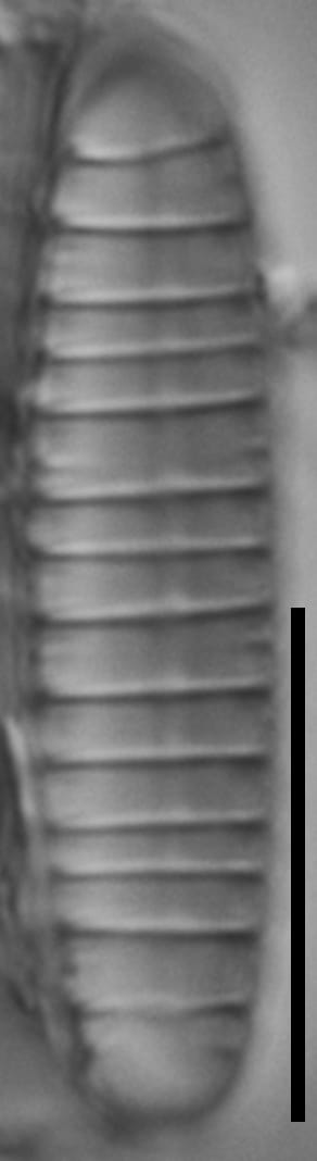 Diatoma problematica LM1