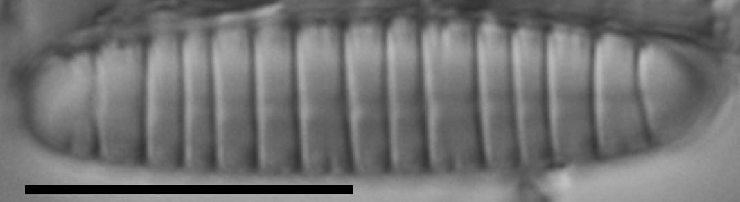 Diatoma problematica LM1