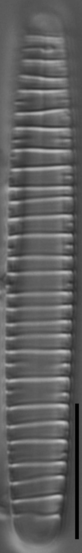 Diatoma problematica LM2