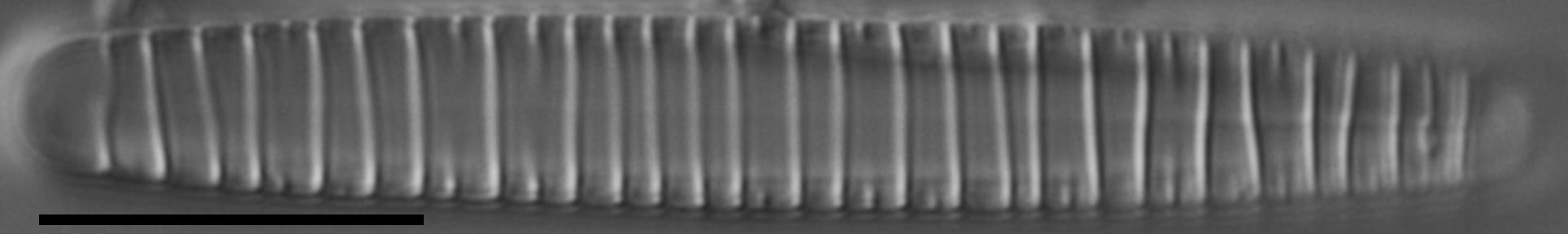 Diatoma problematica LM2