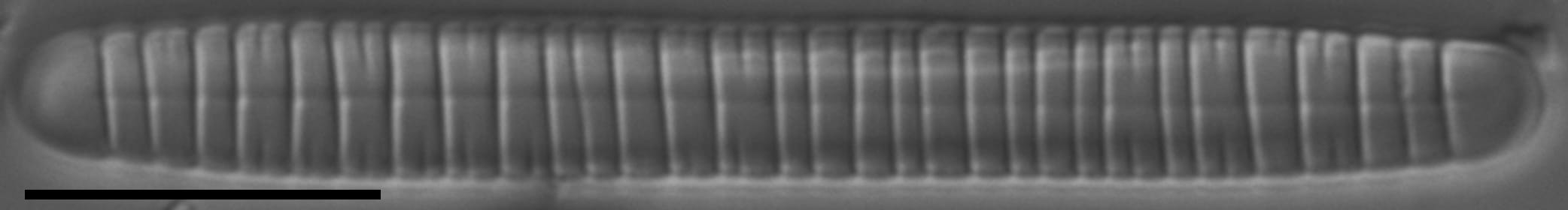 Diatoma problematica LM3