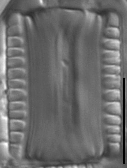 Diatoma problematica LM7