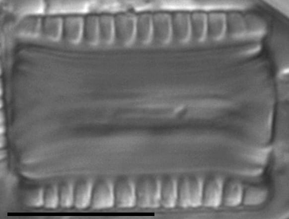 Diatoma problematica LM7
