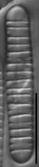 Diatoma problematica LM4