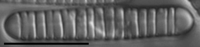 Diatoma problematica LM4