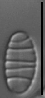 Diatoma problematica LM5