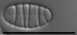 Diatoma problematica LM5