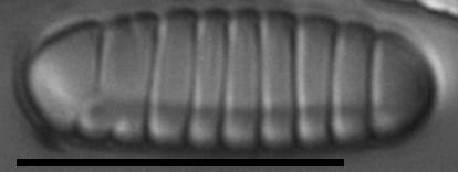 Diatoma problematica LM6