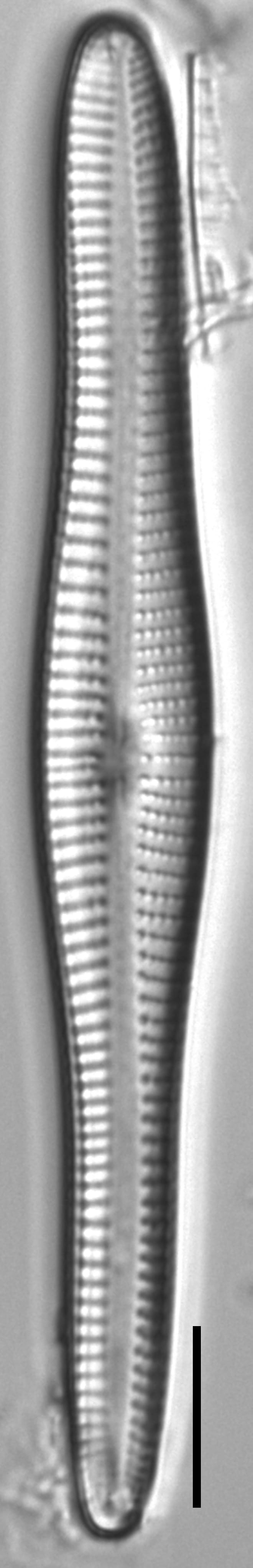 Gomphonema vibroides LM2