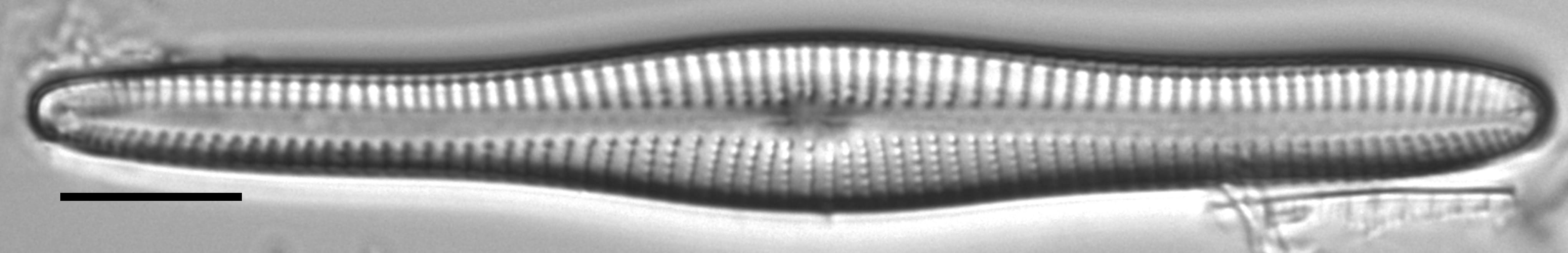 Gomphonema vibroides LM2