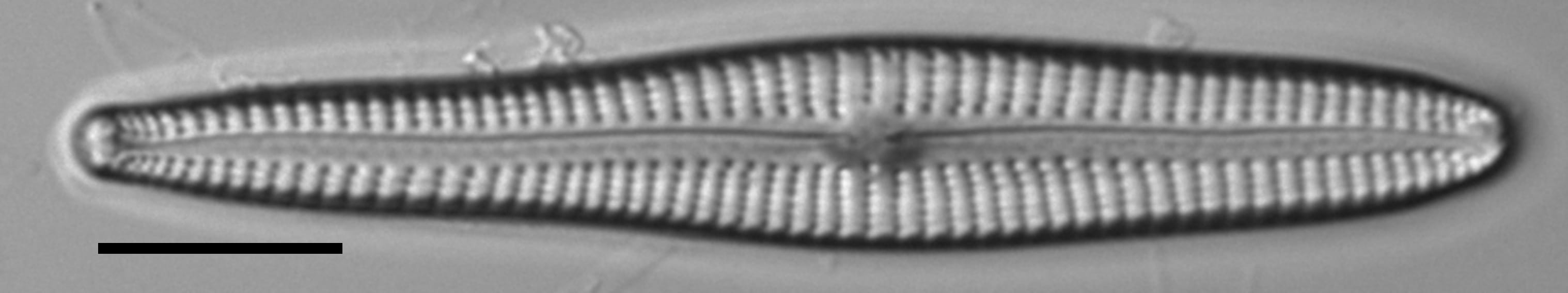 Gomphonema vibroides LM7